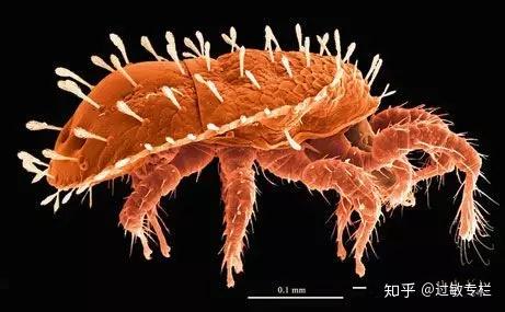 mites bites,Mites Bites: Understanding the Intricacies and Implications