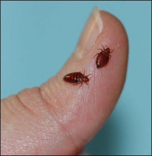 bed bug bite remedy,Bed Bug Bite Remedy: A Comprehensive Guide