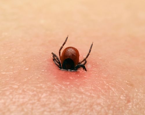 tick bite,Understanding Tick Bites: A Comprehensive Guide