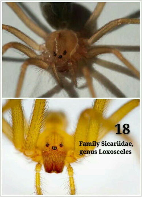 treating brown recluse bite,Understanding the Brown Recluse Spider Bite