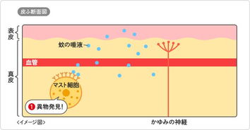 huge insect bite,Huge Insect Bite: A Detailed Overview